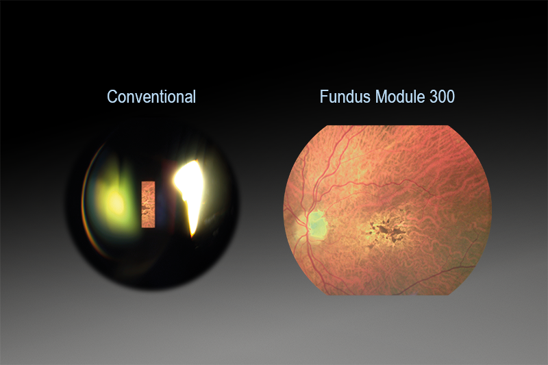 FUNDUS MODULE 300