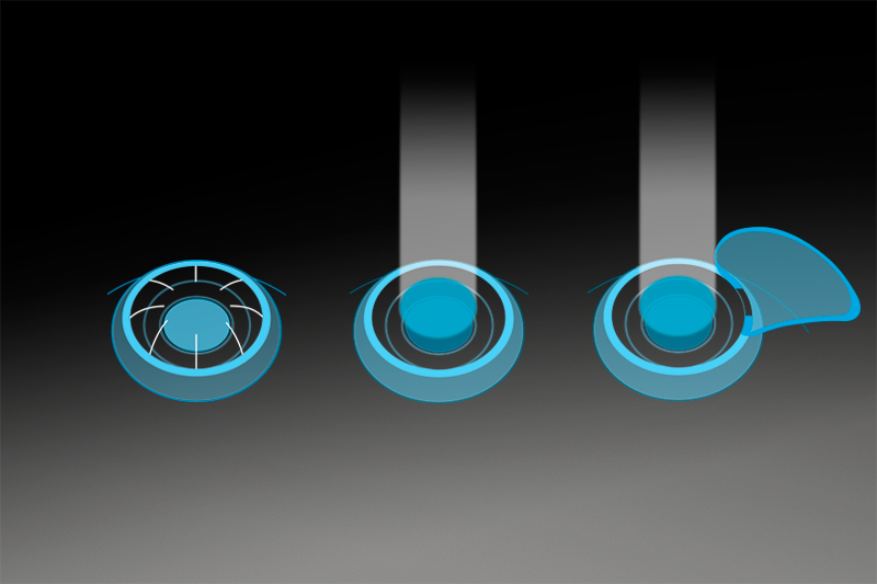 POST REFRACTIVE SOLUTIONS